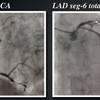 ECG-130：answer