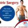 Bariatric Surgery in Delhi – Important Points to Keep in Mind