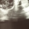 双子妊娠26週5日。検診日！