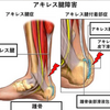 滑液包の話。