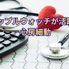 アップルウォッチが活躍！心房細動
