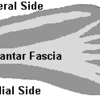 What Are The Indicators Of Posterior Calcaneal Spur