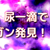 ついにここまで来た！尿一滴からガンを発見！？