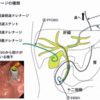 PTGBDの適応