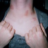 Easy Step By Action Hickey Removal Tips how to give a hickeys  a guy