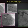 ECG-266：answer(1/2)