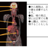 むし歯の原因と予防の再考察②