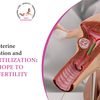 Intrauterine insemination and in-vitro fertilization: A ray of hope to solve infertility