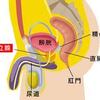 治らない前立腺炎や副鼻腔炎はウイルスが原因