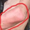 高齢者の皮膚トラブル･還暦過ぎて健康の悩み。