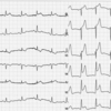 ECG-099：E098の一週間後の出来事です。