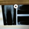 【猫の膝蓋骨脱臼】うーちゃん保存療法を選んで1年8ヶ月経過しました
