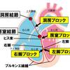   【基礎から学ぶ】房室ブロック【解剖生理学】