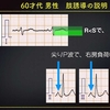 EECG-225：answer