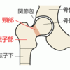 ふとももの付け根の骨が折れた