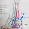 足のしびれ( 足根菅症候群)