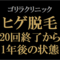 【ゴリラクリニック】ヒゲ脱毛終了から1年後のヒゲの状態は？ジェントルヤグ（ヤグレーザー）