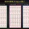 ECG-280：answer