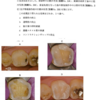 116回歯科医師国家試験【116C-23】保存修復学：フロアブルコンポジットレジン編