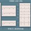 【ECG-403】answer