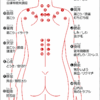 自分で鍼を打ってみた