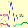 心電図PQ時間延長・短縮の原因