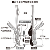 子どもの痔の症状とリスクファクター