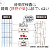 骨粗鬆症⑤骨密度検査は骨質は診ていない