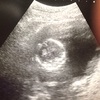 胎動に感動した！