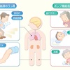 じじぃの「死ぬということ・第5章・虚血性心疾患・心不全！死の雑学」