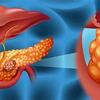 『膵臓がんのリスクは果物で減少、野菜と大豆で増加！』